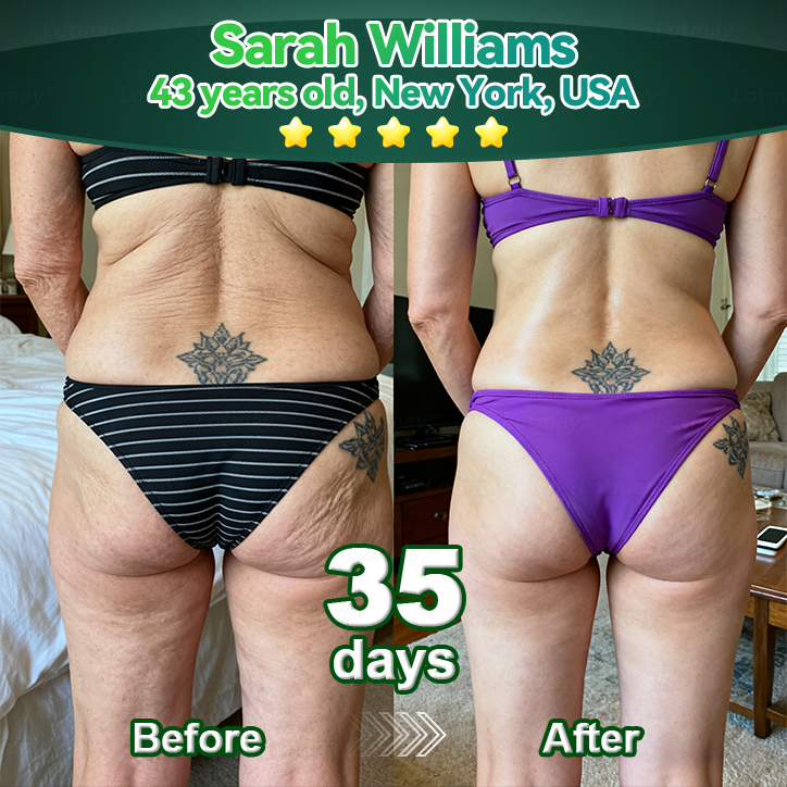 GFOUK® Stem Cell & Collagen Peptide Oral Drops (Lift & Firm Sagging Skin & Reduce Wrinkle Formation)🍀