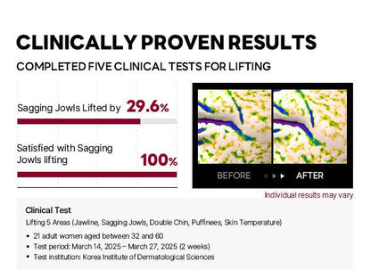 Camellia Deep Collagen Chin Lifting Gel Mask – Neck Solution, Double Chin Reducer, Defined Jawline Shaper, Firming, Jeju Camellia Ingredients for Skin Repair🍀