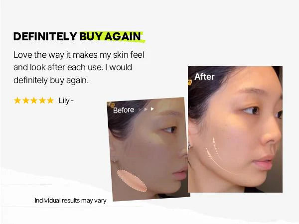 Camellia Deep Collagen Chin Lifting Gel Mask – Neck Solution, Double Chin Reducer, Defined Jawline Shaper, Firming, Jeju Camellia Ingredients for Skin Repair🍀