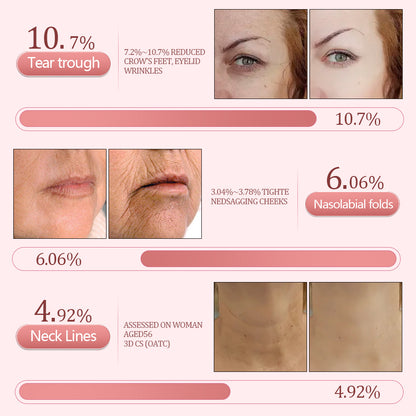 flysmus® NAD+ Wrinkle Bounce Multi-Repair Stick | All-in-One rejuvenating balm that can be used as an eye cream, neck cream, lip balm, makeup primer, or moisturizing mist alternative