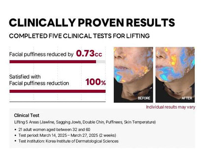 Camellia Deep Collagen Chin Lifting Gel Mask – Neck Solution, Double Chin Reducer, Defined Jawline Shaper, Firming, Jeju Camellia Ingredients for Skin Repair🍀